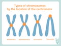 Chromosome type of according position of centromere: metacentric, submetacentric, acrocentric, telocentric Royalty Free Stock Photo